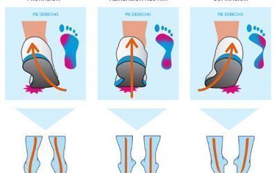 Análisis de la pisada – Podologia deportiva, ¿Pronador, Supinador?.